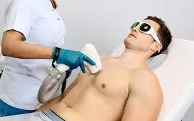 Depilación láser masculina: la nueva referencia en tratamientos estéticos en España